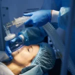 Patient receiving general anesthesia during medical procedure requiring post-surgery transportation planning in Texas
